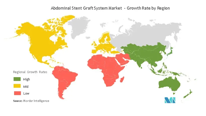 Abdomial Stent Graft System Market-Geography trend.jpg
