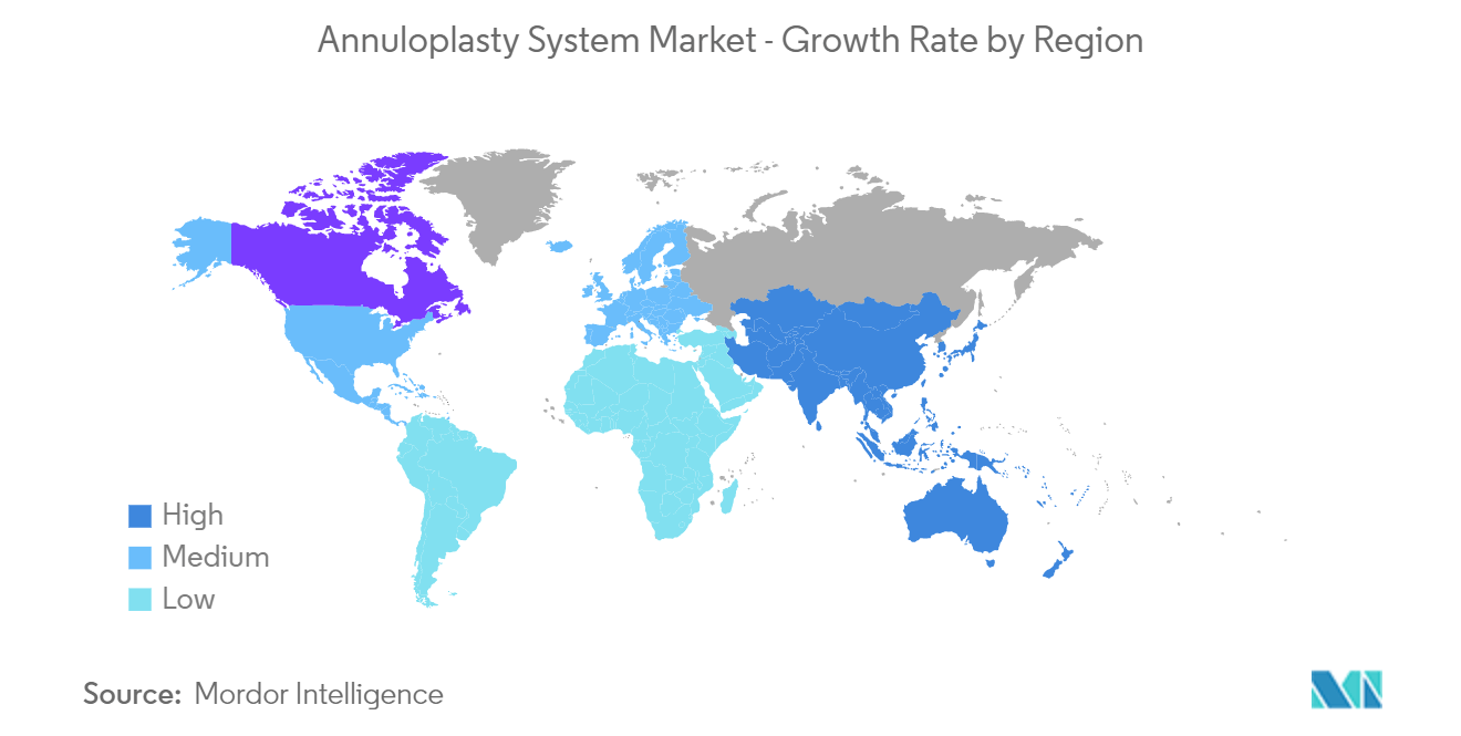 Annuloplasty System Market - Growth Rate by Region