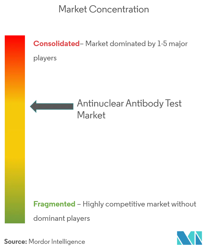 anti-nuclear antibody (ana) testing market analysis
