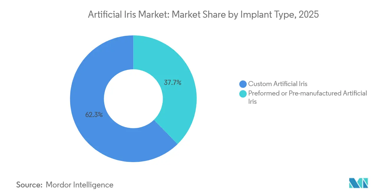 Marktanteil für künstliche Iris nach Implantattyp, 2025