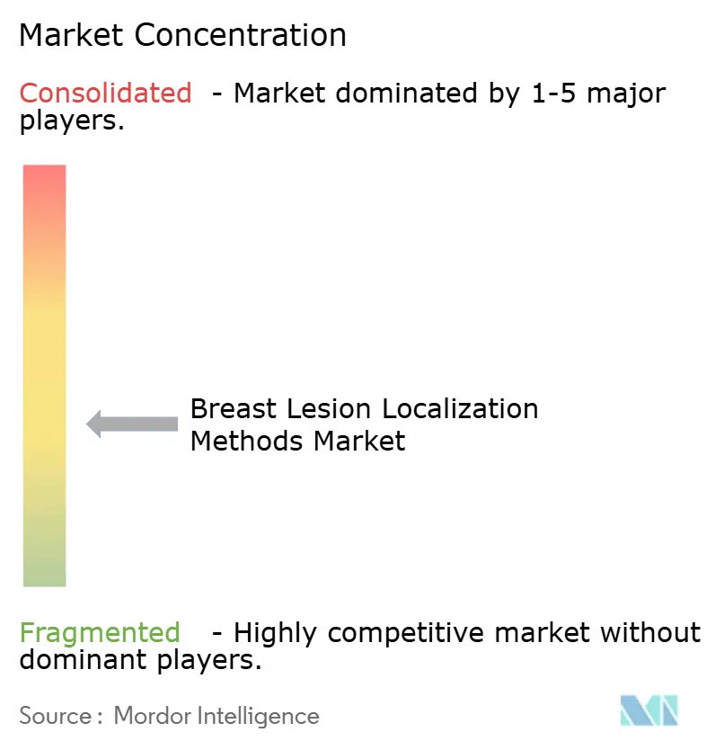 Breast Lesion Localization Methods Market Concentration