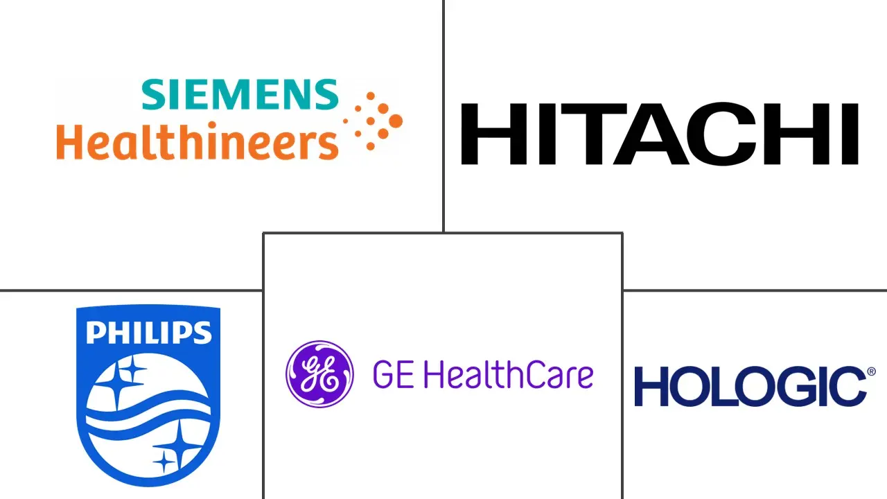 Major players in Breast Ultrasound industry