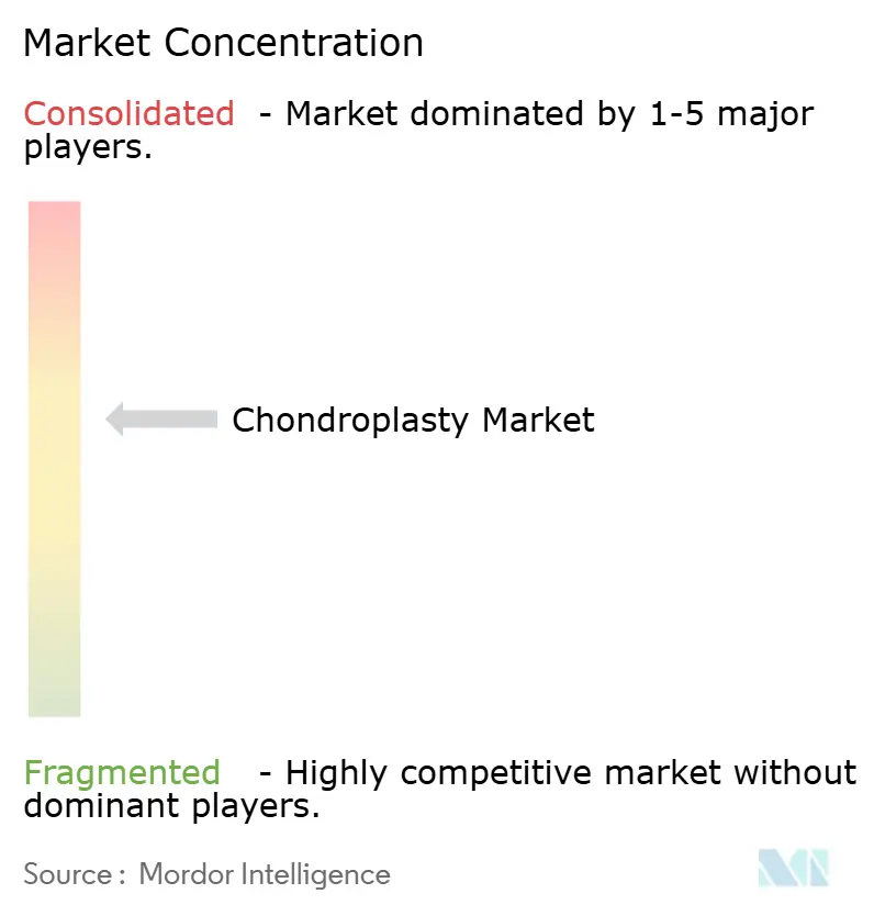 Chondroplasty Market Concentration