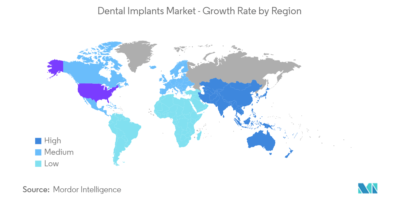 种植牙市场-按地区划分的增长率