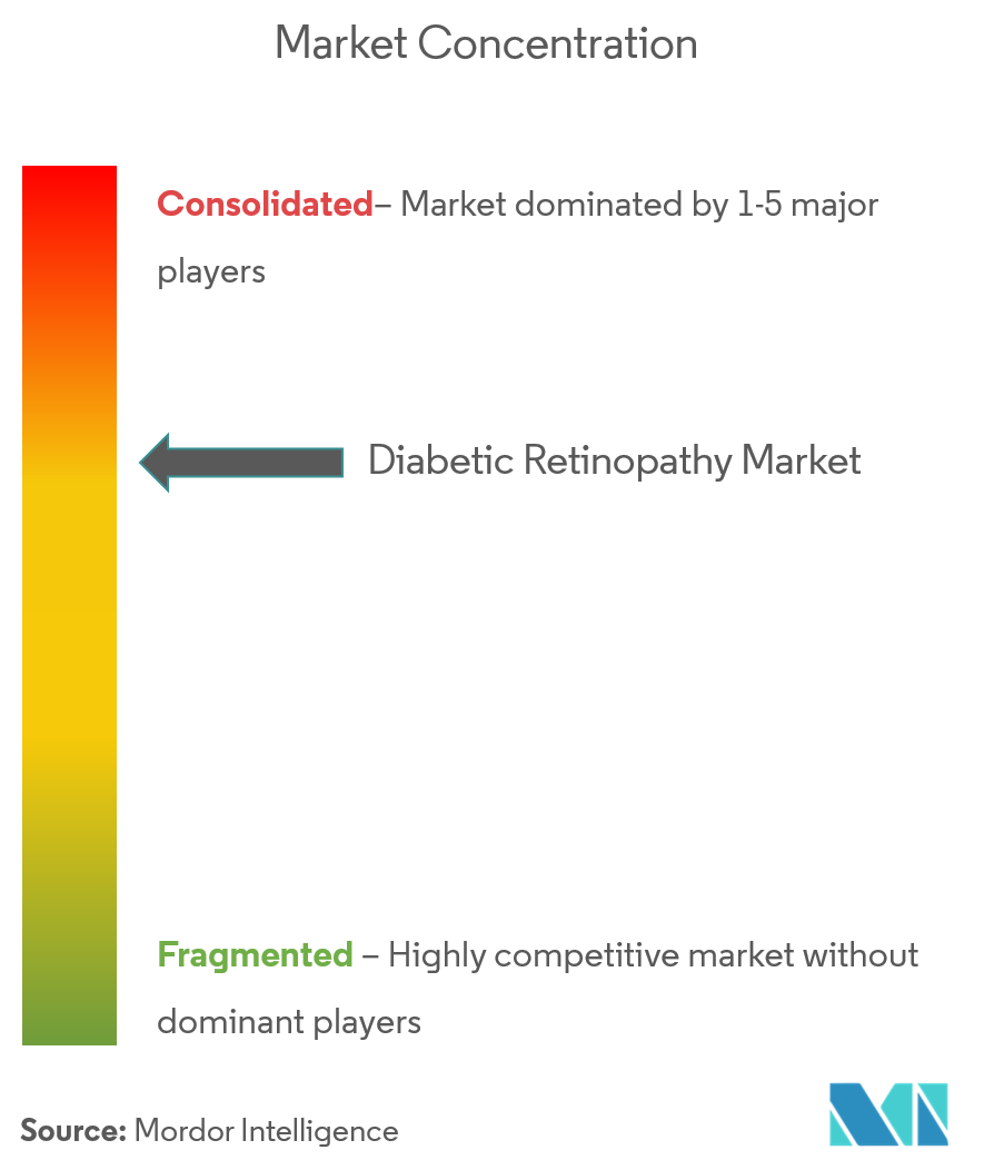 Diabetic Retinopathy Market Concentration