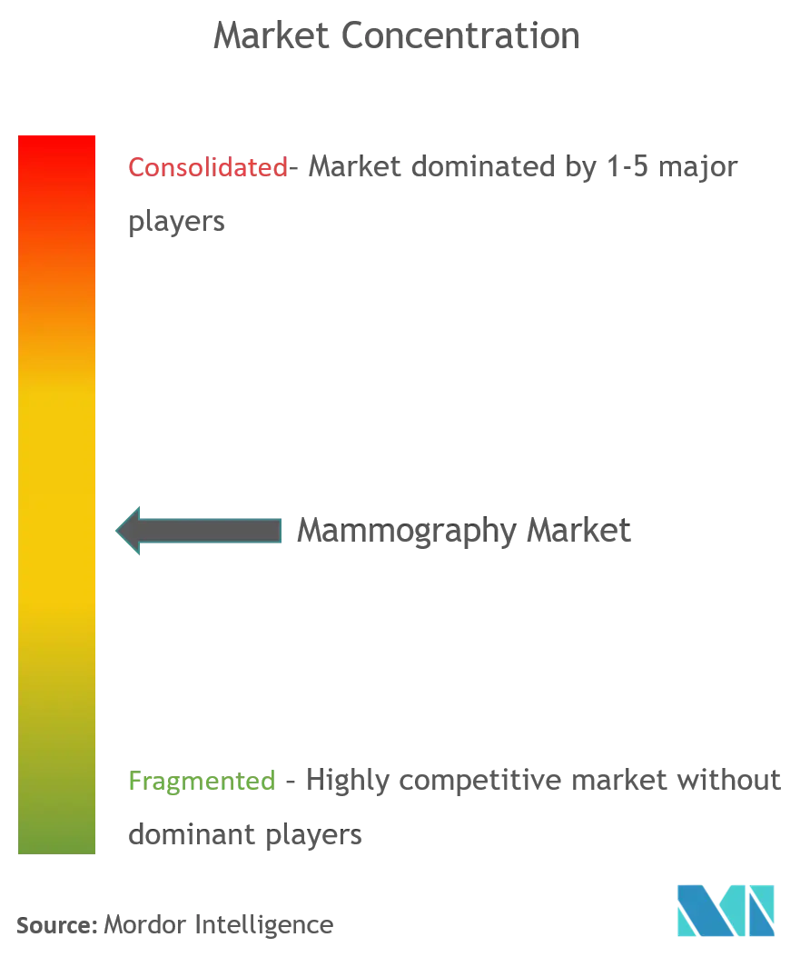 Global Mammography Market Concentration