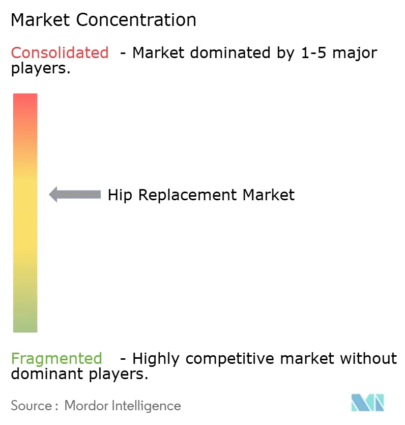 Hip Replacement Market Concentration