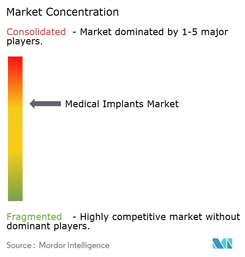 Medical Implants Market Concentration