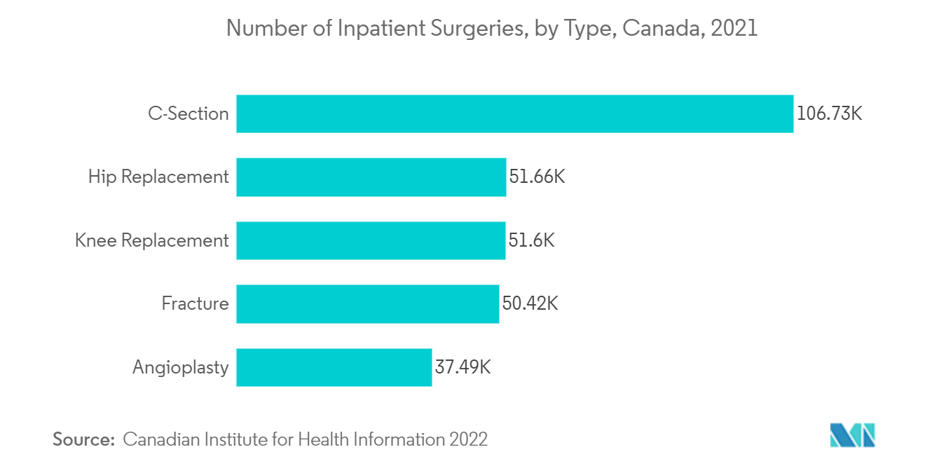 Mercado de dispositivos cirúrgicos gerais da América do Norte – Número de cirurgias hospitalares, por tipo, Canadá, 2021