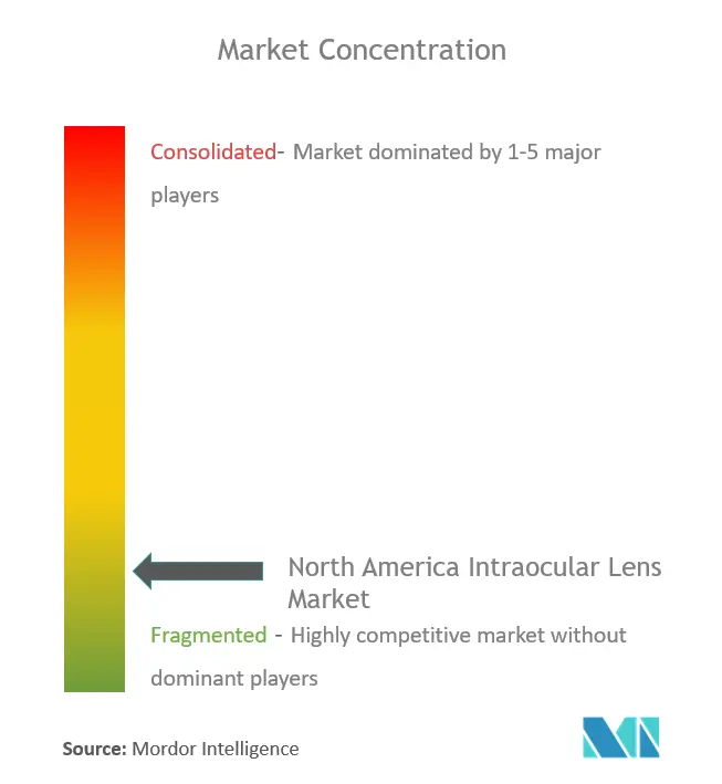北米眼内レンズ市場集中度