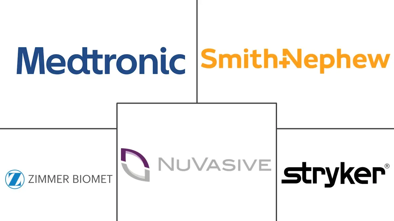 Major players in Orthopedic Navigation Systems industry