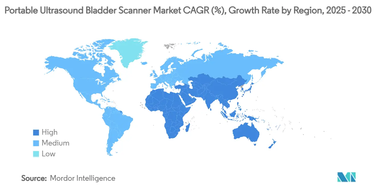 휴대용 안전한 바카라사이트 산타카지노 방광 스캐너 시장 CAGR(%), 지역별 성장률