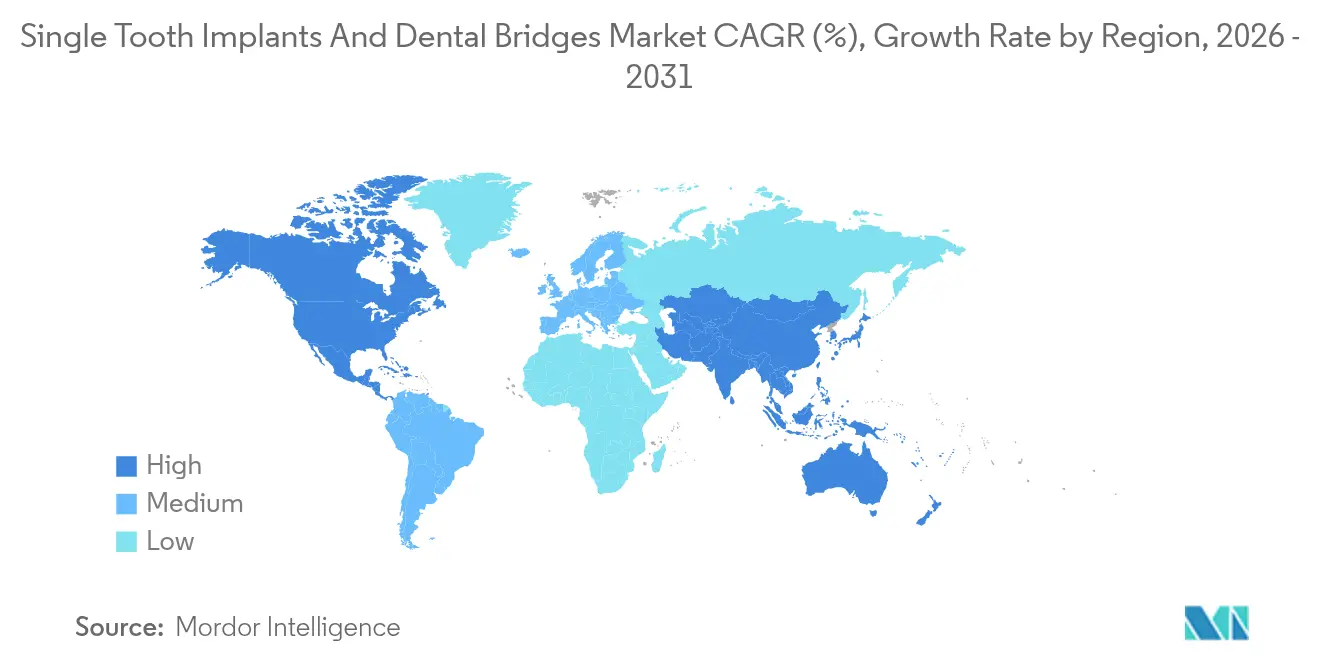 Single Tooth Implants And Dental Bridges Market CAGR (%), Growth Rate by Region