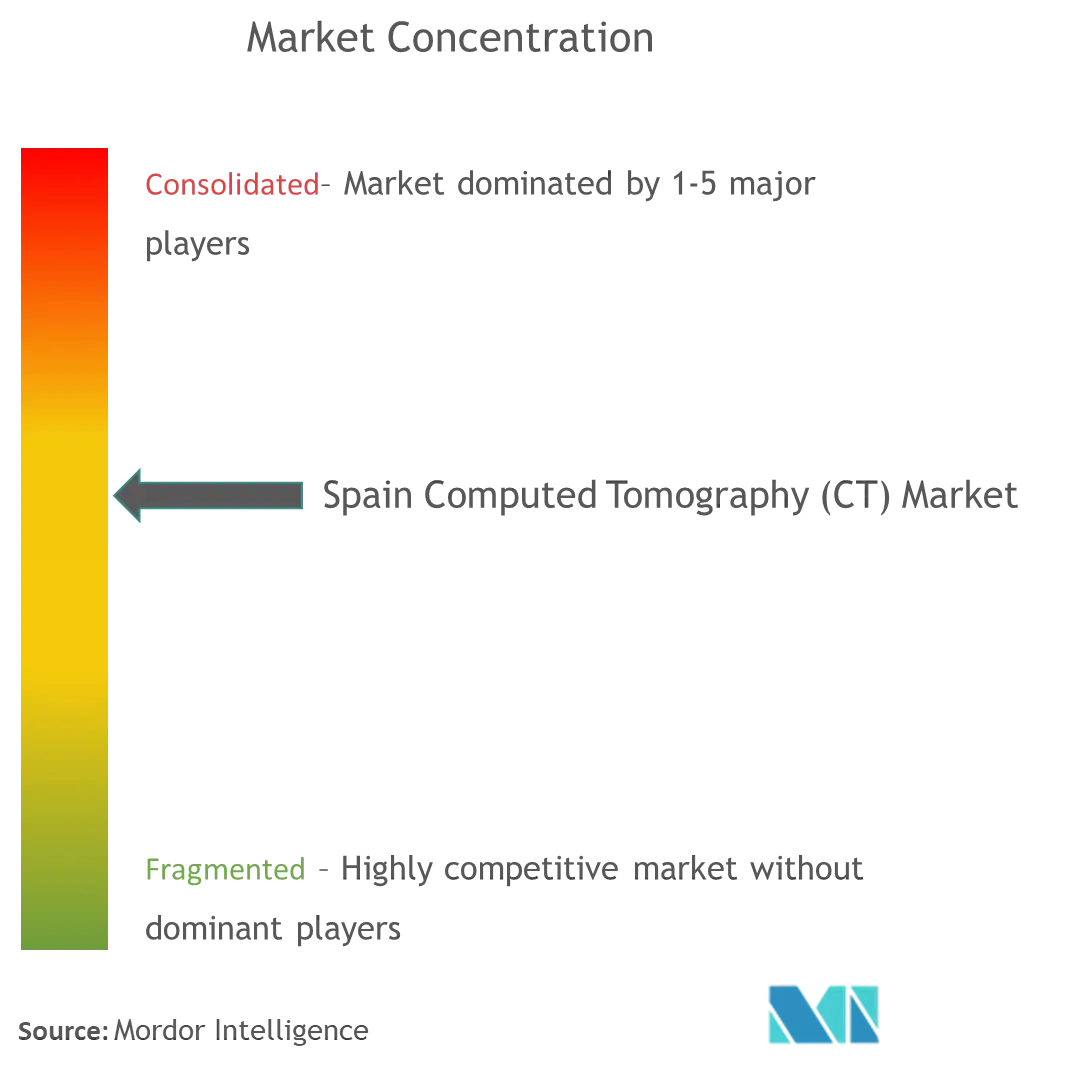 Spain Computed Tomography Market Concentration
