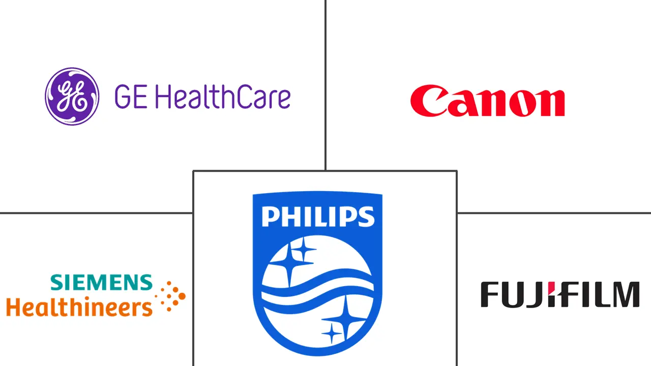 Ultrasound Transducer Market Major Players