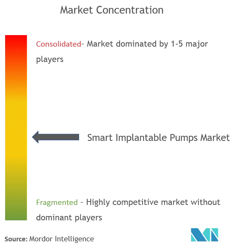 Smart Implantable Pumps Market Concentration